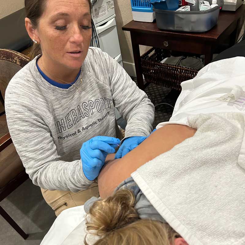 Dry Needling Dry Needling